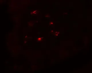 Anti-CTHRC1 antibody used in IHC (Paraffin sections) (IHC-P). GTX31944