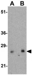 Anti-CTHRC1 antibody used in Western Blot (WB). GTX31944