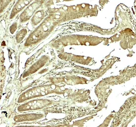 Anti-Adenosine A2b Receptor antibody used in IHC (Paraffin sections) (IHC-P). GTX31945