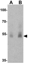 Anti-SLC29A1 antibody used in Western Blot (WB). GTX31946