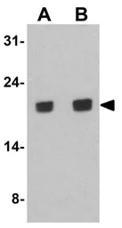 Anti-SFRS3 antibody used in Western Blot (WB). GTX31947