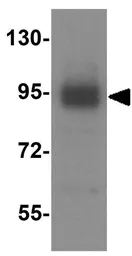 Anti-LSD1 antibody used in Western Blot (WB). GTX31950
