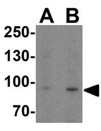 Anti-LRRC8A antibody used in Western Blot (WB). GTX31953