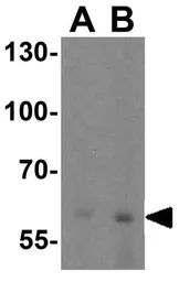 Anti-SLC38A4 antibody used in Western Blot (WB). GTX31954