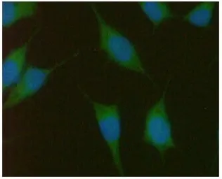 Anti-PMVK antibody [AT21C10] used in Immunocytochemistry/ Immunofluorescence (ICC/IF). GTX31956
