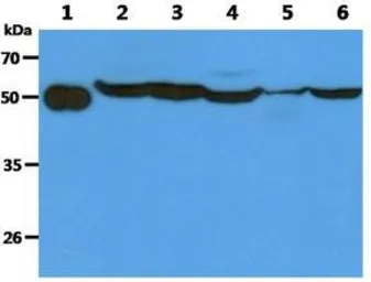Anti-TBCEL antibody [AT1B10] used in Western Blot (WB). GTX31958