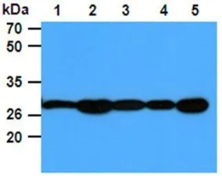 Anti-PGAM1 antibody [AT1G4] used in Western Blot (WB). GTX31959