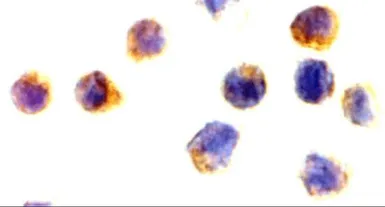 Anti-CNKSR1 antibody used in Immunocytochemistry/ Immunofluorescence (ICC/IF). GTX31960