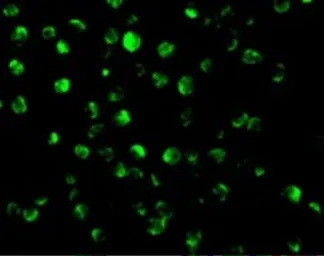 Anti-CNKSR1 antibody used in Immunocytochemistry/ Immunofluorescence (ICC/IF). GTX31960