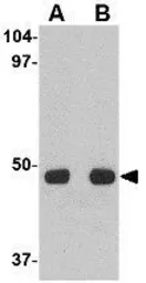 Anti-UNC93A antibody used in Western Blot (WB). GTX31964
