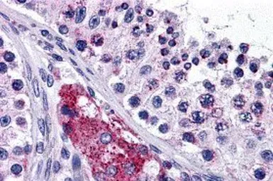 Anti-PTCHD2 antibody used in IHC (Paraffin sections) (IHC-P). GTX31966