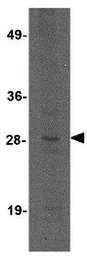 Anti-KLRA3 antibody used in Western Blot (WB). GTX31969