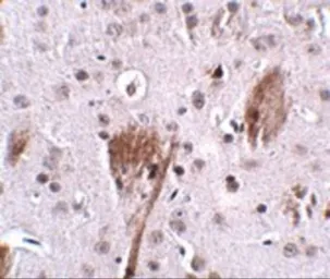 Anti-SPG11 antibody used in IHC (Paraffin sections) (IHC-P). GTX31970
