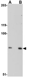 Anti-SPG11 antibody used in Western Blot (WB). GTX31970