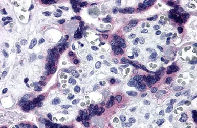 Anti-TTBK2 antibody used in IHC (Paraffin sections) (IHC-P). GTX31971