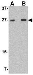 Anti-TMEM18 antibody used in Western Blot (WB). GTX31972