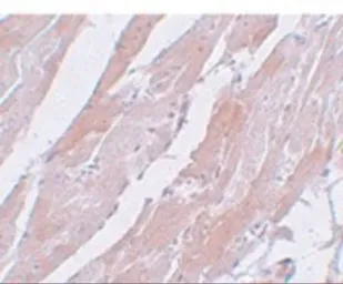 Anti-CCDC47 antibody used in IHC (Paraffin sections) (IHC-P). GTX31976