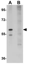 Anti-SLFN12 antibody used in Western Blot (WB). GTX31980