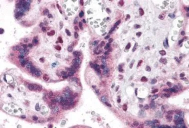 Anti-IRF2BP2 antibody used in IHC (Paraffin sections) (IHC-P). GTX31982