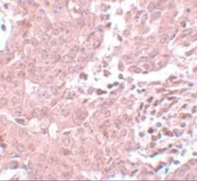 Anti-BCAS3 antibody used in IHC (Paraffin sections) (IHC-P). GTX31983