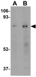 Anti-RANBP10 antibody used in Western Blot (WB). GTX31986