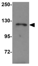 Anti-NLRP13 antibody used in Western Blot (WB). GTX31990