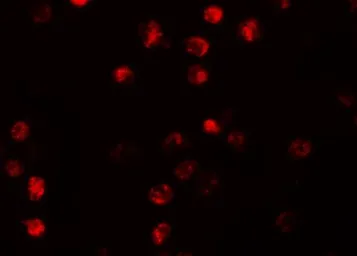Anti-NLRP13 antibody used in Immunocytochemistry/ Immunofluorescence (ICC/IF). GTX31990