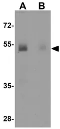 Anti-KPNA7 antibody used in Western Blot (WB). GTX31991