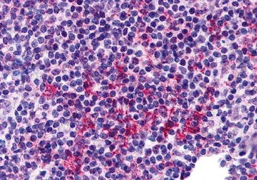 Anti-ZNF687 antibody used in IHC (Paraffin sections) (IHC-P). GTX31993