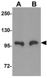 Anti-SLC39A10 antibody used in Western Blot (WB). GTX31994