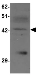 Anti-SLC39A13 antibody used in Western Blot (WB). GTX31995