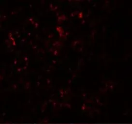 Anti-SLC39A14 antibody used in IHC (Paraffin sections) (IHC-P). GTX31996
