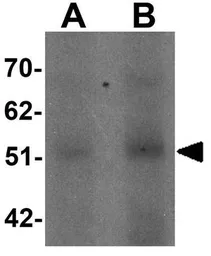 Anti-SLC39A14 antibody used in Western Blot (WB). GTX31996