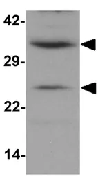 Anti-CXXC5 antibody used in Western Blot (WB). GTX31997