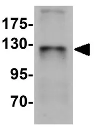 Anti-ZBTB4 antibody used in Western Blot (WB). GTX31998