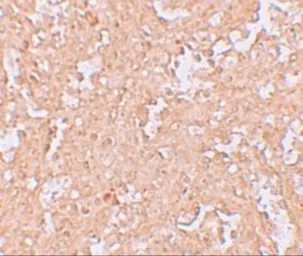 Anti-ZBTB8 antibody used in IHC (Paraffin sections) (IHC-P). GTX31999