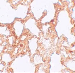 Anti-ZMYM1 antibody used in IHC (Paraffin sections) (IHC-P). GTX32000
