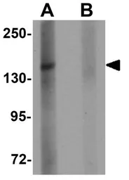 Anti-ZMYM1 antibody used in Western Blot (WB). GTX32000
