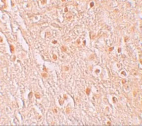 Anti-PION antibody used in IHC (Paraffin sections) (IHC-P). GTX32001