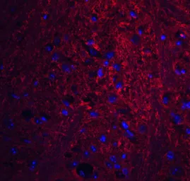Anti-PION antibody used in IHC (Paraffin sections) (IHC-P). GTX32001