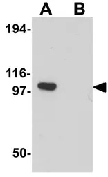 Anti-PION antibody used in Western Blot (WB). GTX32001