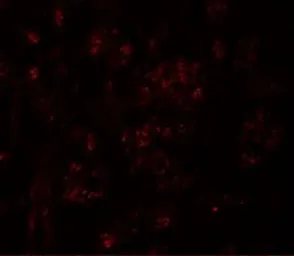 Anti-PION antibody used in IHC (Paraffin sections) (IHC-P). GTX32001