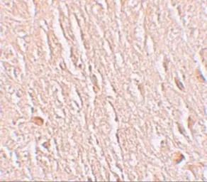 Anti-LRRTM3 antibody used in IHC (Paraffin sections) (IHC-P). GTX32003