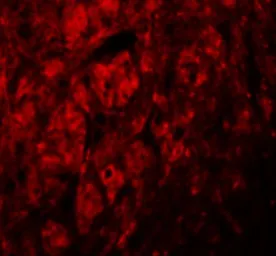 Anti-LRRTM3 antibody used in IHC (Paraffin sections) (IHC-P). GTX32003