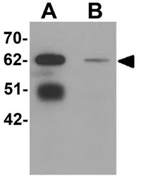 Anti-LRRTM3 antibody used in Western Blot (WB). GTX32003