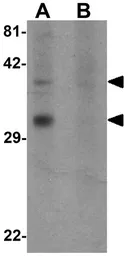 Anti-OGFOD2 antibody used in Western Blot (WB). GTX32004