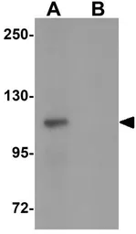 Anti-VPS39 antibody used in Western Blot (WB). GTX32005