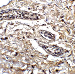 Anti-BCL9L antibody used in IHC (Paraffin sections) (IHC-P). GTX32006