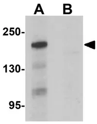 Anti-BCL9L antibody used in Western Blot (WB). GTX32006