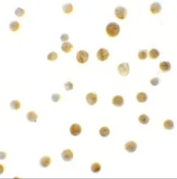 Anti-BCL9L antibody used in Immunocytochemistry/ Immunofluorescence (ICC/IF). GTX32006